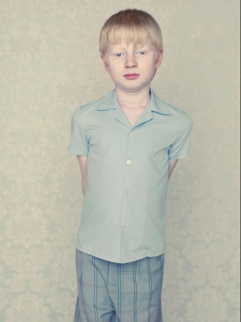 Albinos in the lens of Gustavo Lacerde