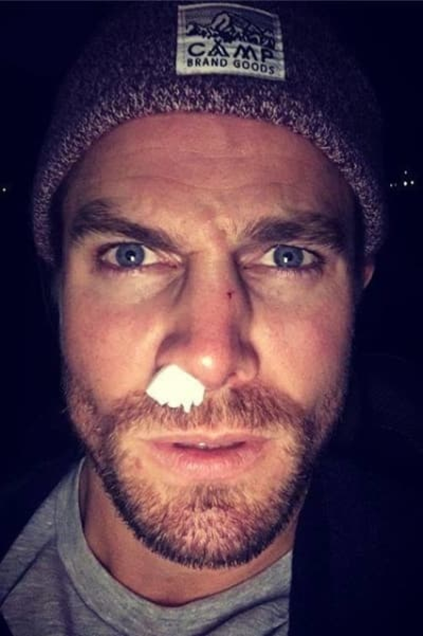 An actor is a dangerous profession! Real injuries of stars on the set