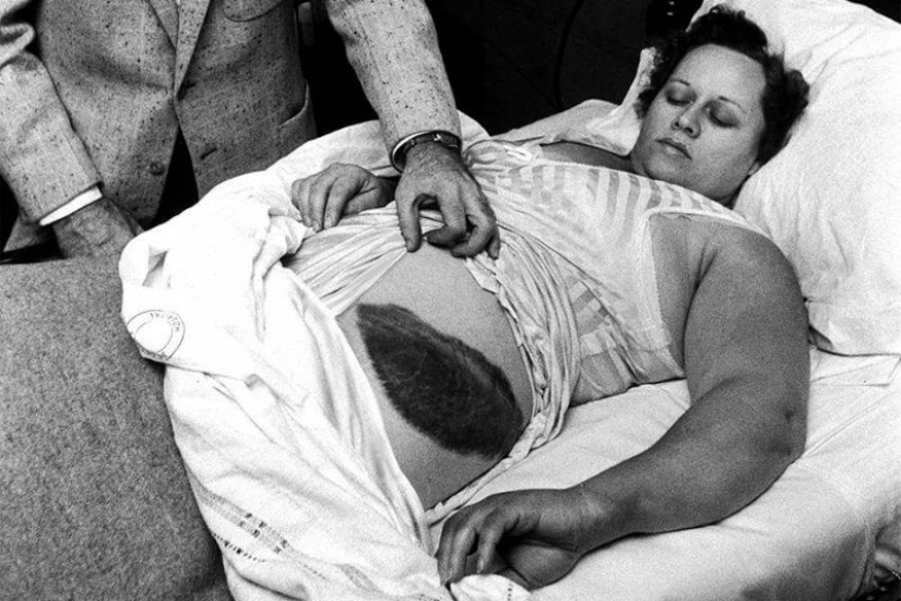 Ann Elizabeth Hodges is the only person who survived after being hit by a meteorite