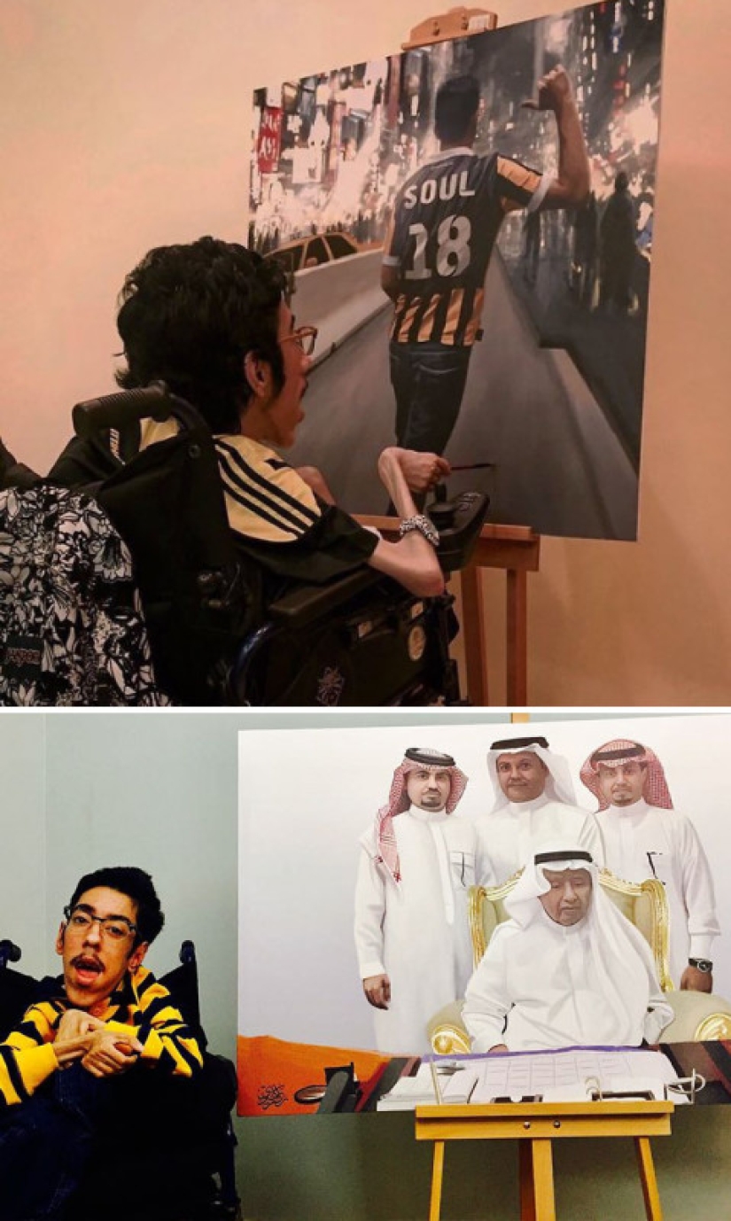 Artists with disabilities who have amazed the world with their talents