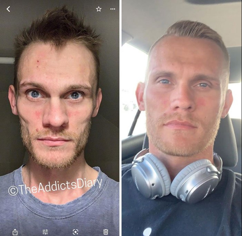 Before and after: 20 photos of people who decided to stop using drugs