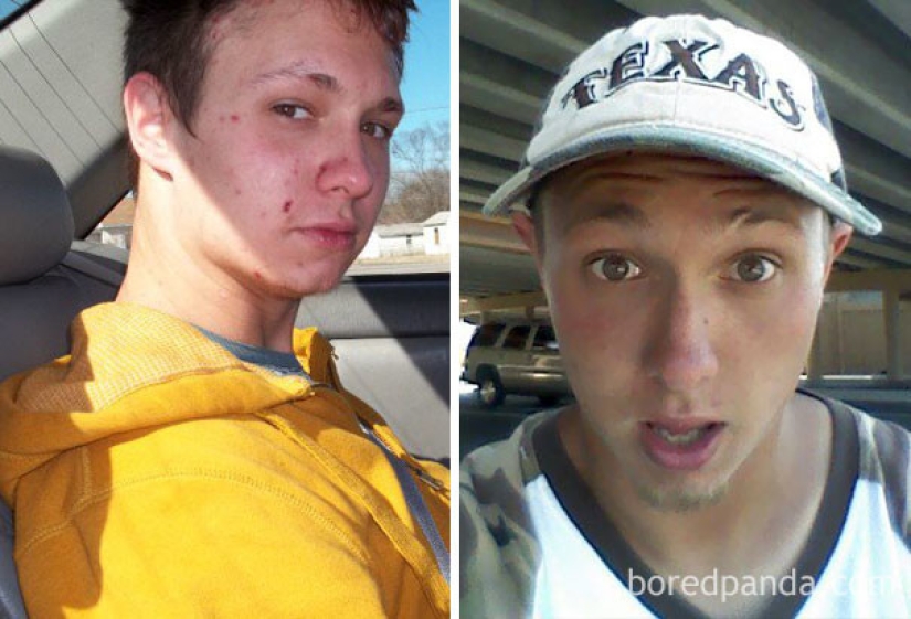 Before and after: 20 photos of people who decided to stop using drugs