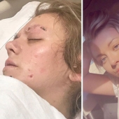 Before and after: 20 photos of people who decided to stop using drugs