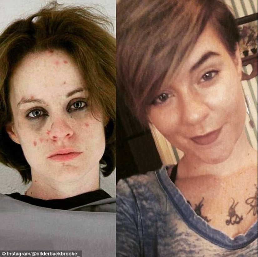 Before and after: 20 photos of people who decided to stop using drugs