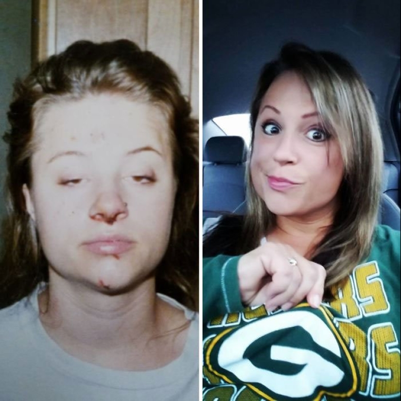 Before and after: 20 photos of people who decided to stop using drugs