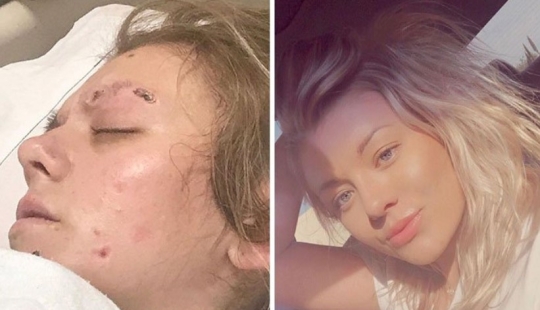 Before and after: 20 photos of people who decided to stop using drugs