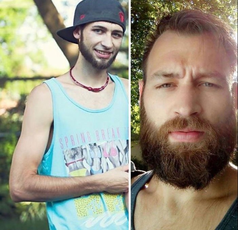 Before and after: 20 photos of people who decided to stop using drugs