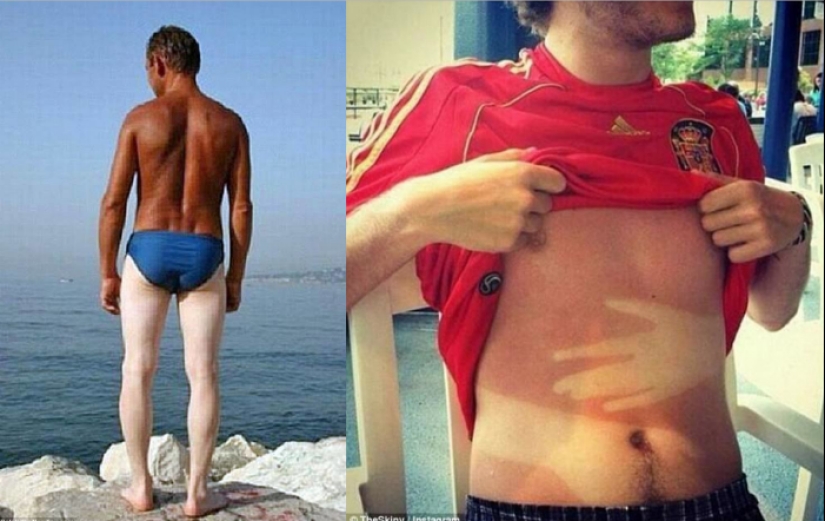 Black on top, white on the bottom — the most failed attempts to tan