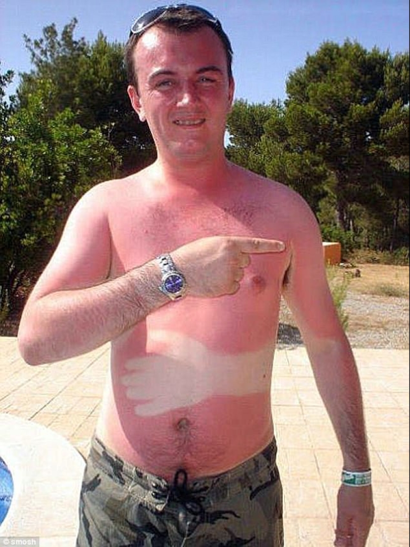 Black on top, white on the bottom — the most failed attempts to tan