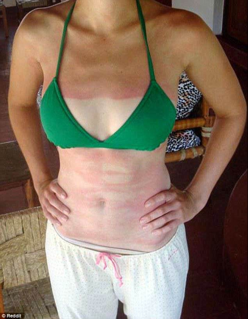 Black on top, white on the bottom — the most failed attempts to tan