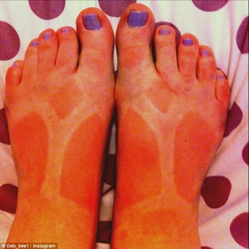 Black on top, white on the bottom — the most failed attempts to tan