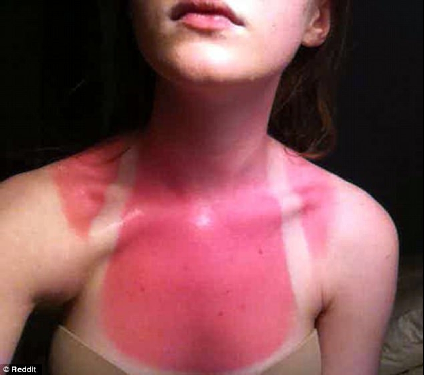 Black on top, white on the bottom — the most failed attempts to tan