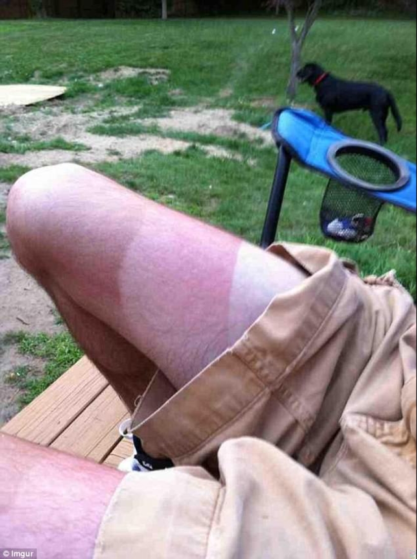 Black on top, white on the bottom — the most failed attempts to tan