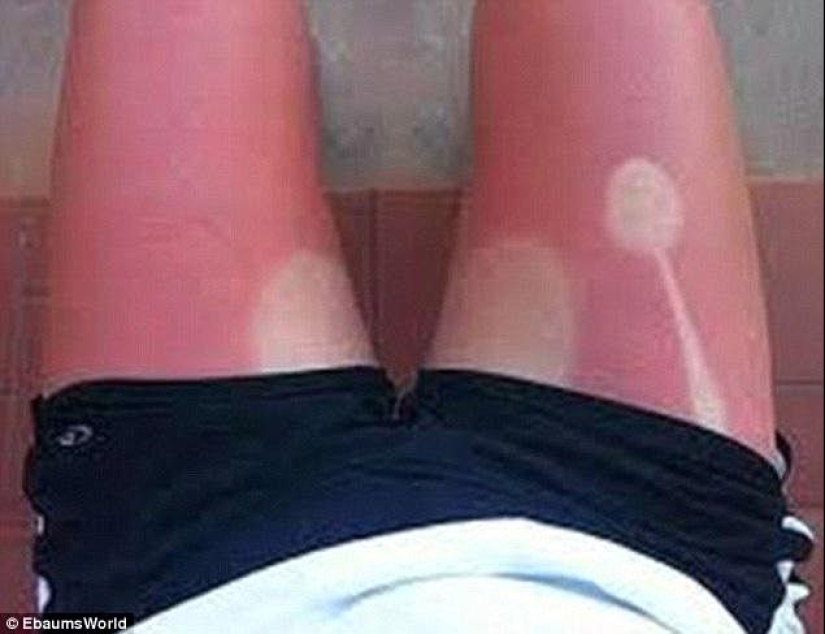 Black on top, white on the bottom — the most failed attempts to tan