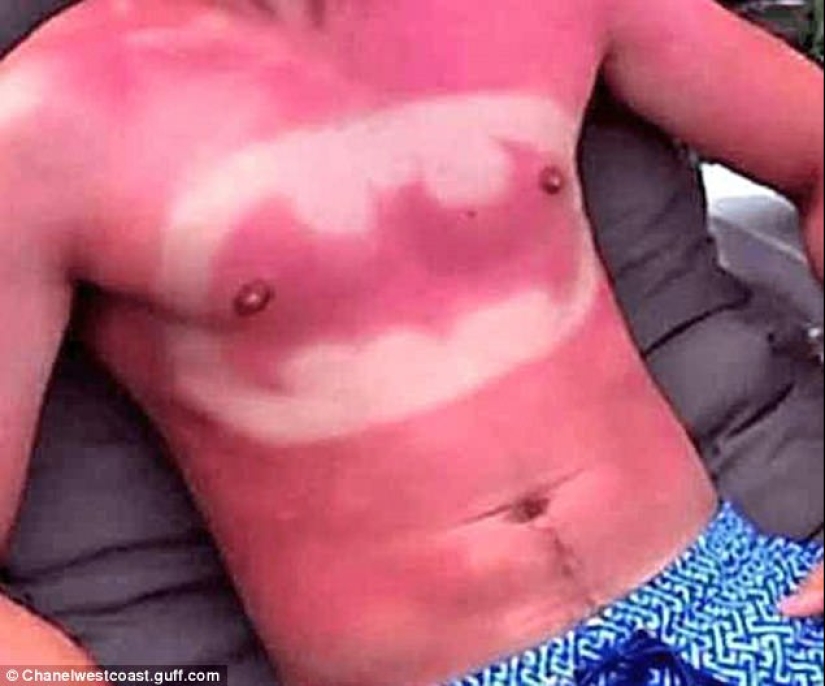 Black on top, white on the bottom — the most failed attempts to tan