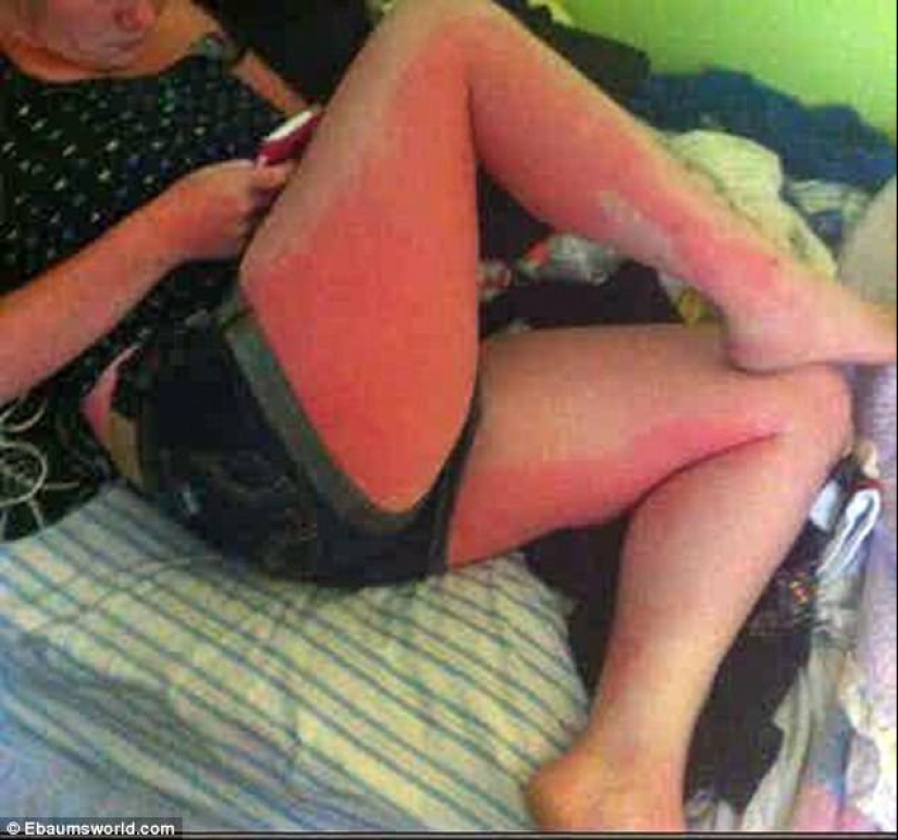 Black on top, white on the bottom — the most failed attempts to tan