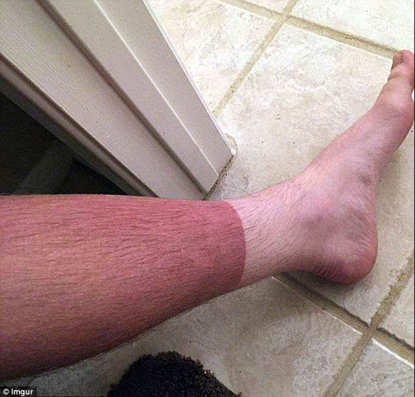 Black on top, white on the bottom — the most failed attempts to tan