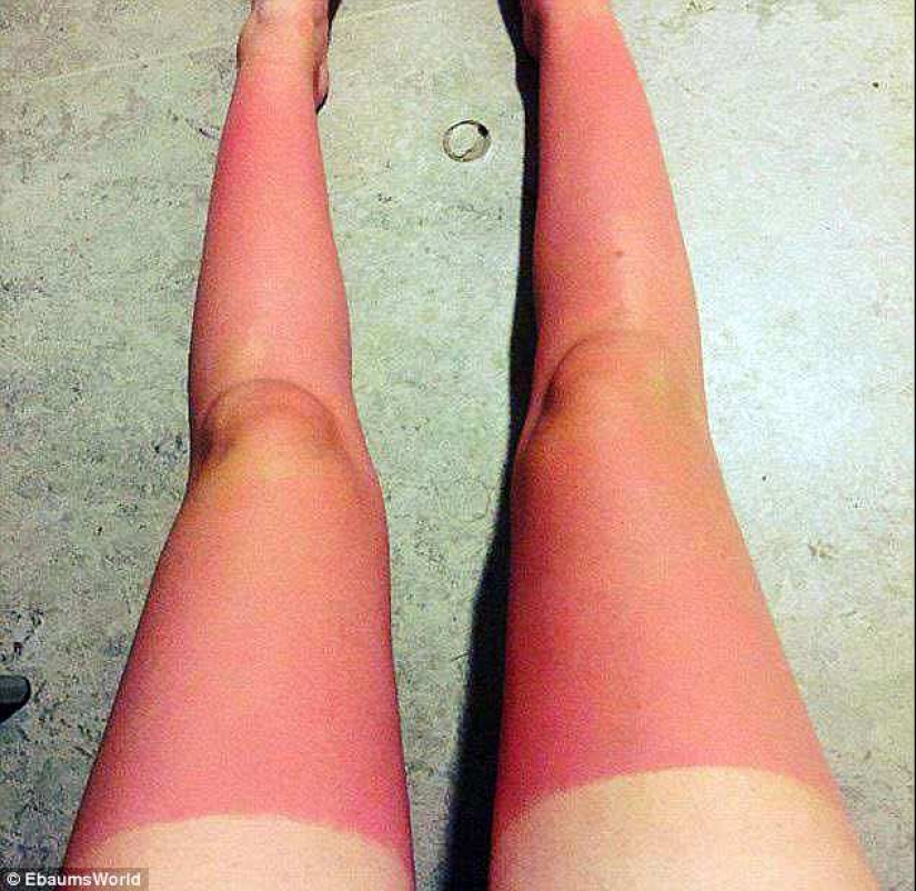 Black on top, white on the bottom — the most failed attempts to tan