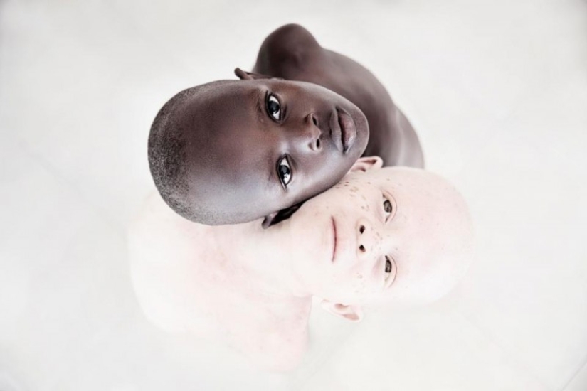 Blancura mortal: Increíbles retratos de albinos de Tanzania