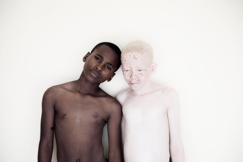 Blancura mortal: Increíbles retratos de albinos de Tanzania