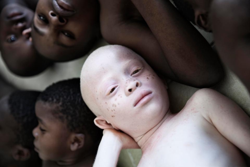 Blancura mortal: Increíbles retratos de albinos de Tanzania