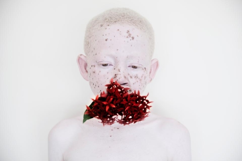 Blancura mortal: Increíbles retratos de albinos de Tanzania