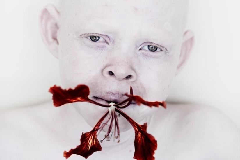 Blancura mortal: Increíbles retratos de albinos de Tanzania