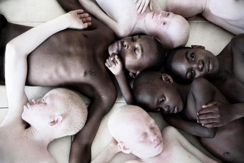 Blancura mortal: Increíbles retratos de albinos de Tanzania