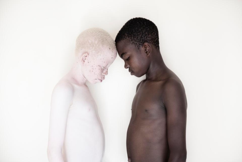 Blancura mortal: Increíbles retratos de albinos de Tanzania