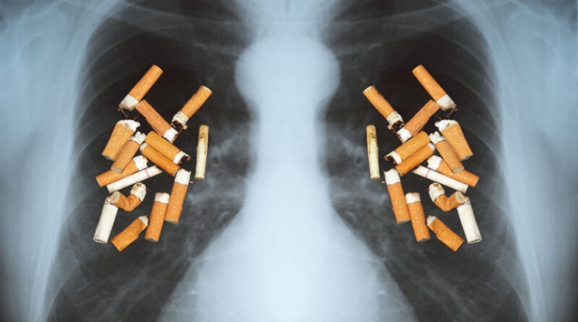 Cómo limpiar los pulmones de fumador: mejores formas en las que trabajo