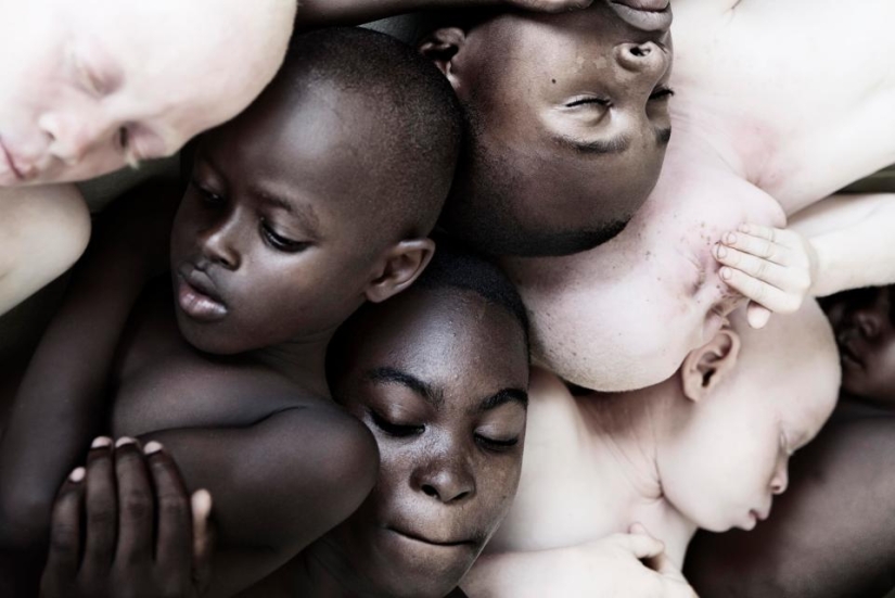 Deadly Whiteness: Incredible portraits of Tanzania's Albinos