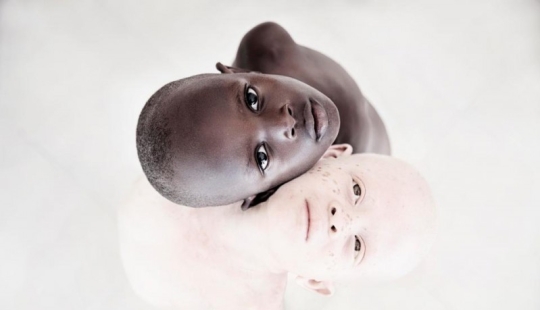 Deadly Whiteness: Incredible portraits of Tanzania's Albinos