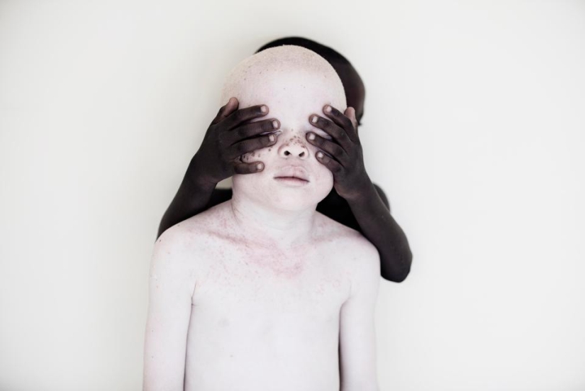 Deadly Whiteness: Incredible portraits of Tanzania's Albinos