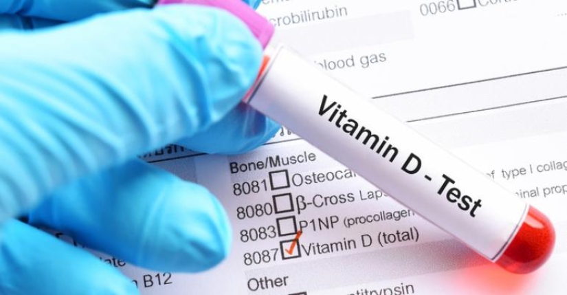 Dispelling 7 myths about vitamin D, which stubbornly continue to believe