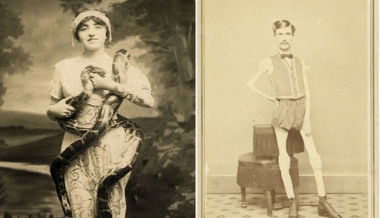 El duro siglo XIX: una colección de fotografías de archivo de personas con deformidades