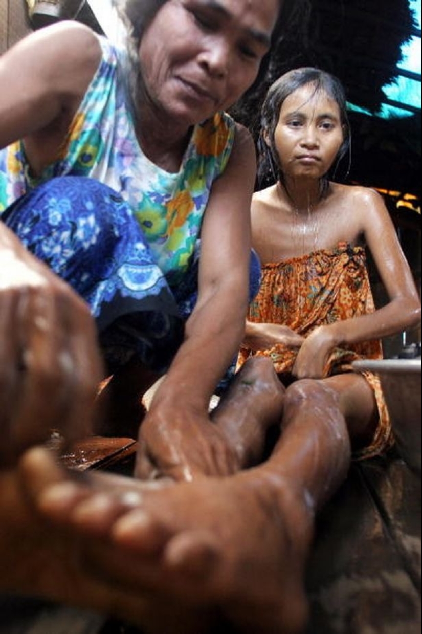 Encontrado en la selva: La triste historia de una mujer camboyana Mowgli