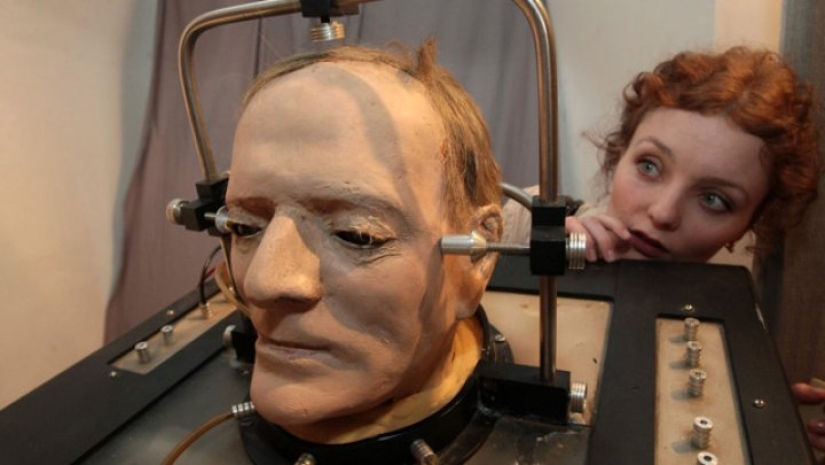 Es posible trasplantar una cabeza humana