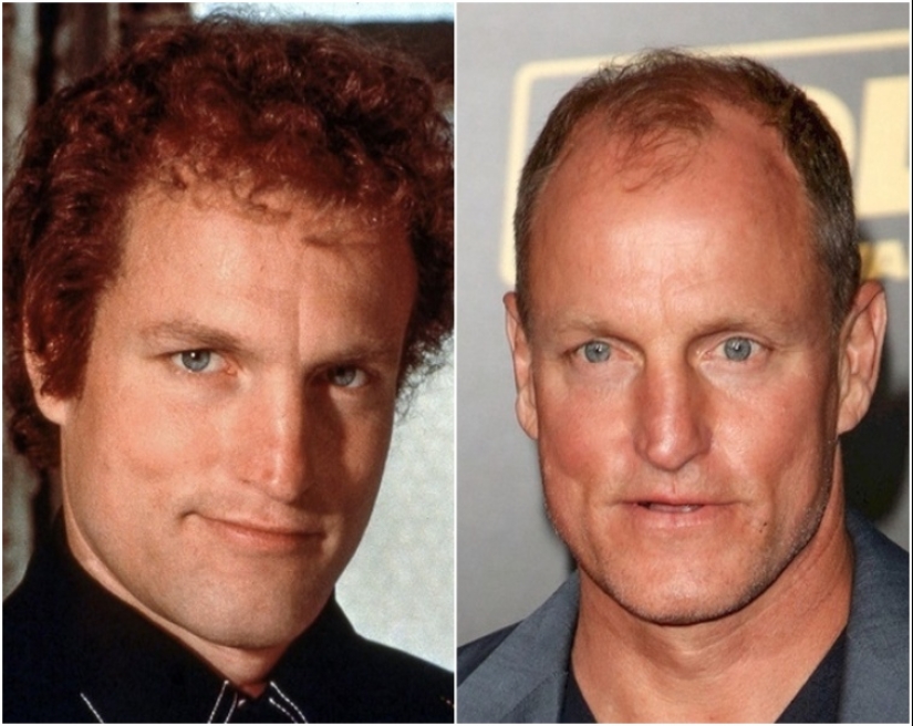 Famous actors before they became bald