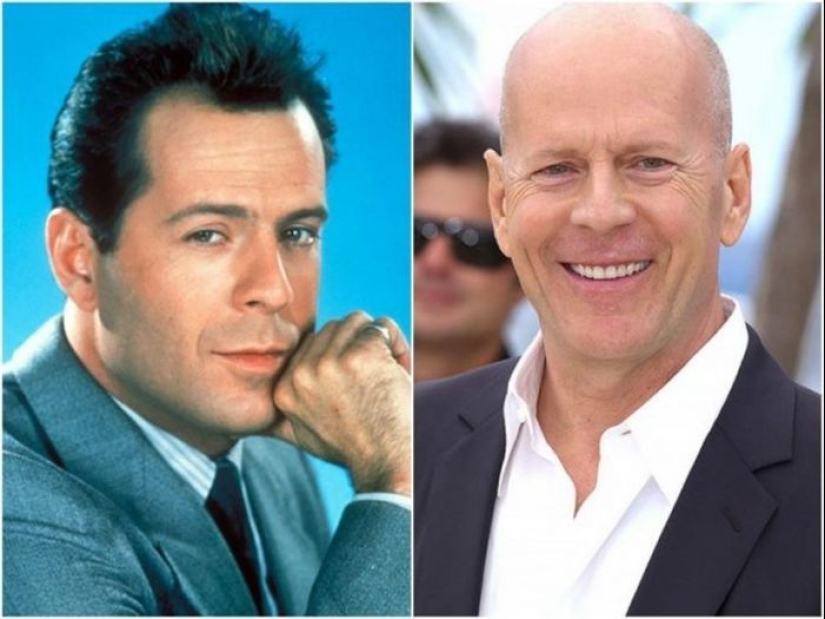 Famous actors before they became bald