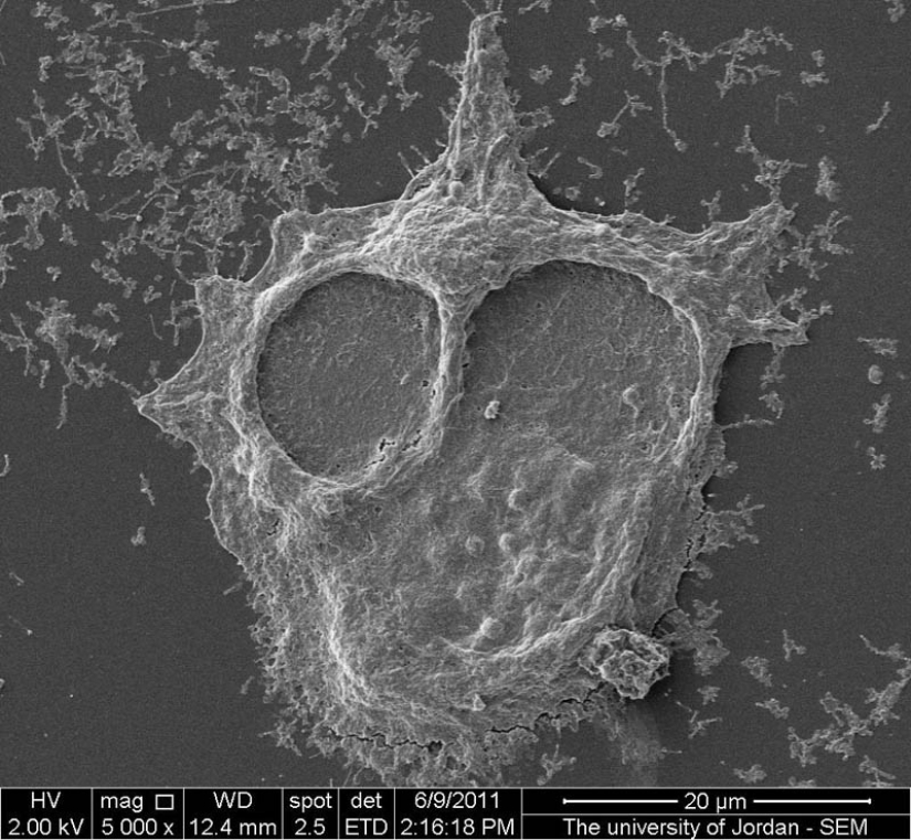 Fotos tomadas con un microscopio electrónico