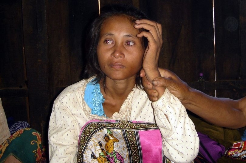 Found in the Jungle: The sad story of a Cambodian Mowgli woman