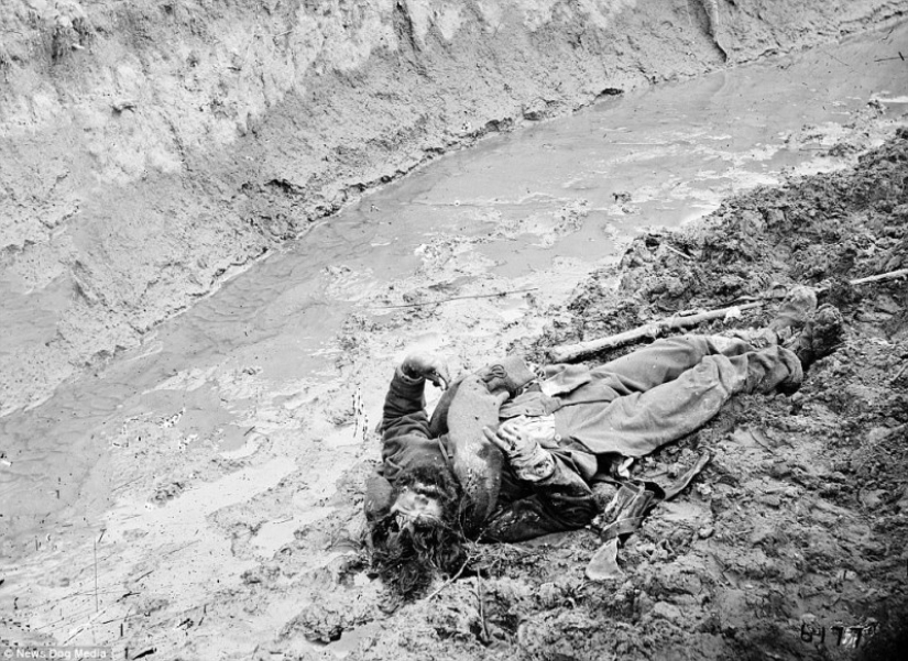 Horrifying photos of victims of the bloodiest war in US history