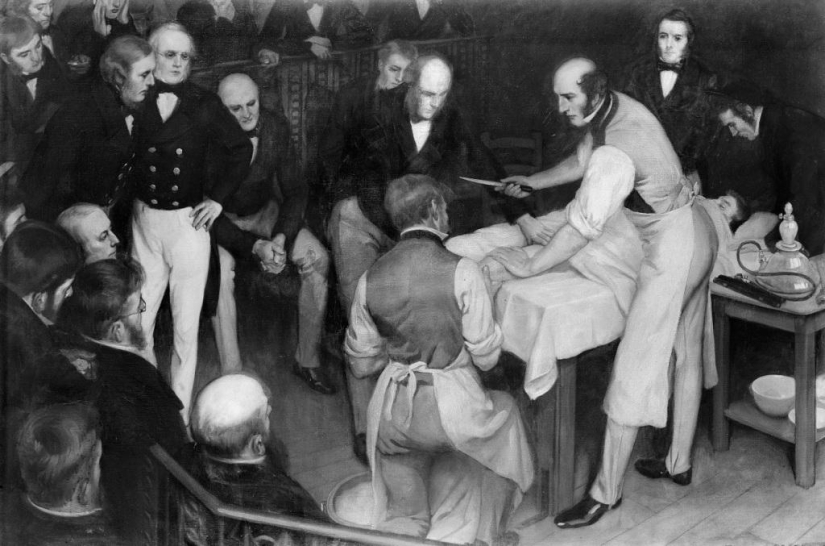 How the English doctor Robert Liston killed three people in one operation