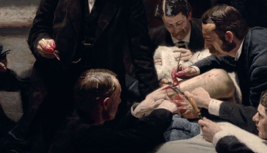 How the English doctor Robert Liston killed three people in one operation