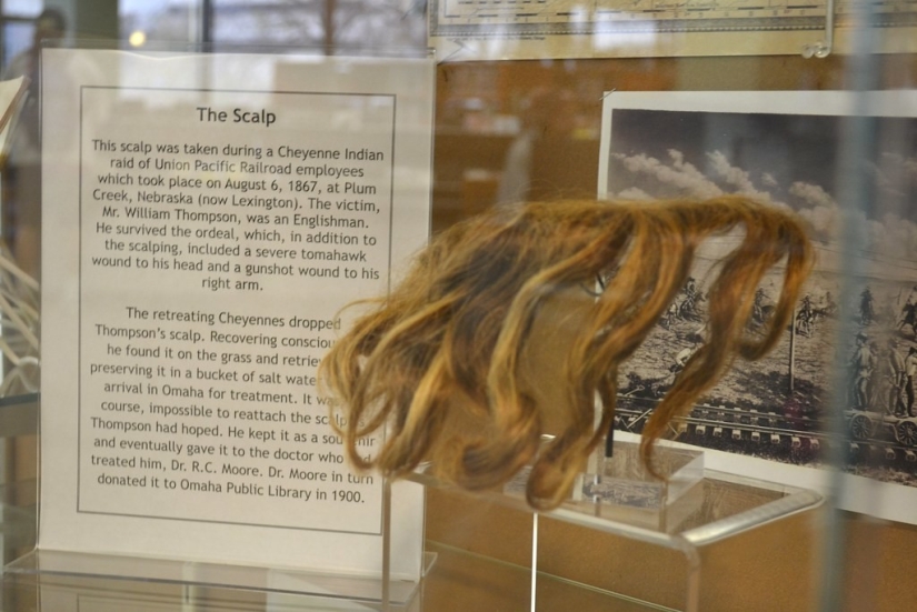 How the Indians scalped an Englishman, and he survived and gave the scalp to the museum: the story of William Thompson