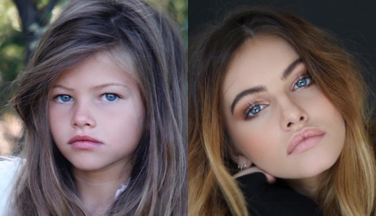 “I Feel Sorry For Her”: People React To New Photos Of World’s “Most Beautiful Girl”