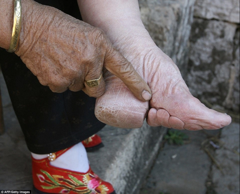 In the village of "Bound Feet" live the last Chinese women suffering from an ancient cruel tradition