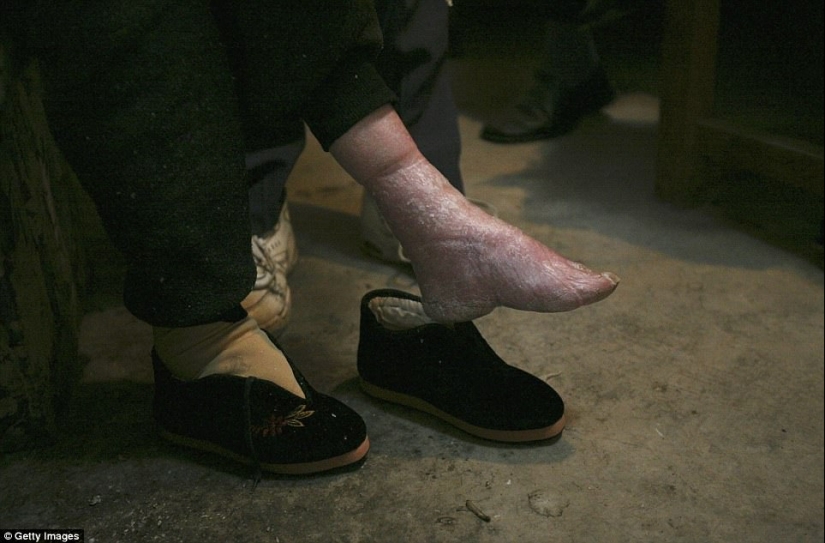 In the village of "Bound Feet" live the last Chinese women suffering from an ancient cruel tradition