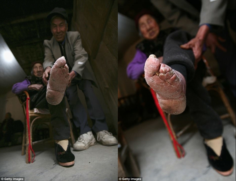 In the village of "Bound Feet" live the last Chinese women suffering from an ancient cruel tradition