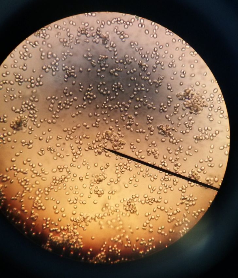 Increíble mundo bajo el microscopio: 22 fotos que te harán ver todo de una manera nueva